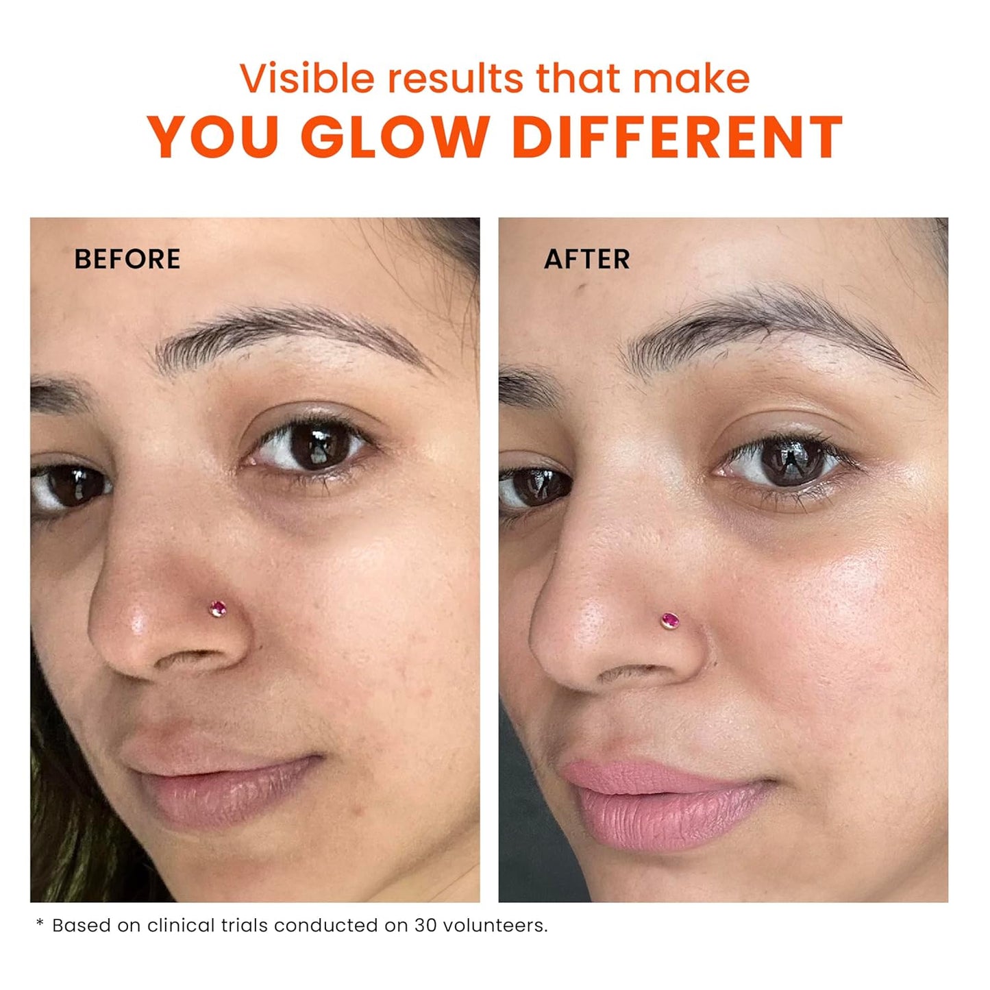 Instant Glow - #1 De-Tan & Brightening Serum + FREE Lip Scrub