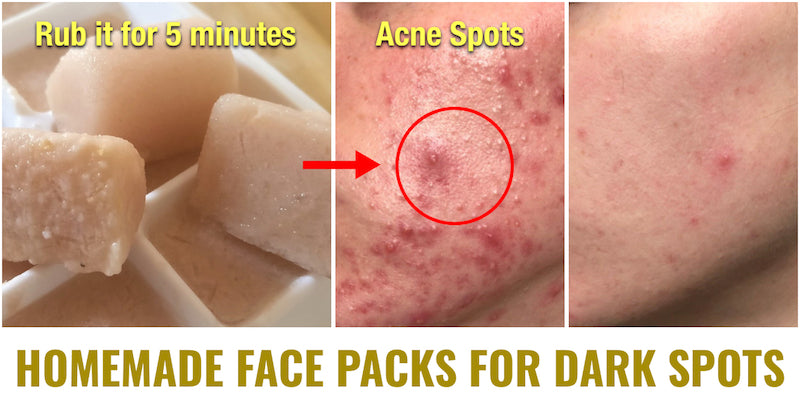 10 Face Packs to Clear Dark Spots